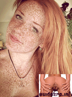 non redheads gorgeous most woman body redhead hair freckles remove freckled ginger porn teen roodharige freckle
