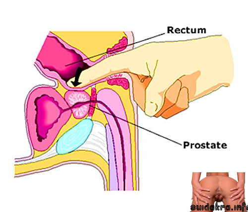 massaging prostate therapist need health using i want a prostate massage professional internal
