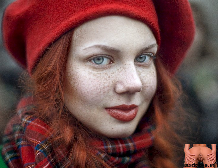 35photo ginger freckle face