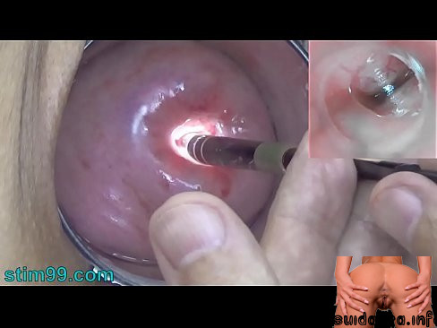 exam penetration cervix inside