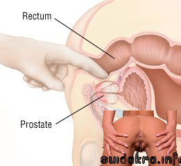 therapy prostate causes prostatitis 3d need
