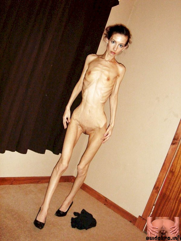 anorexic skinniest skinny old lady porn