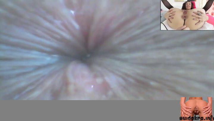 endoscope anal cam casey anus rectum