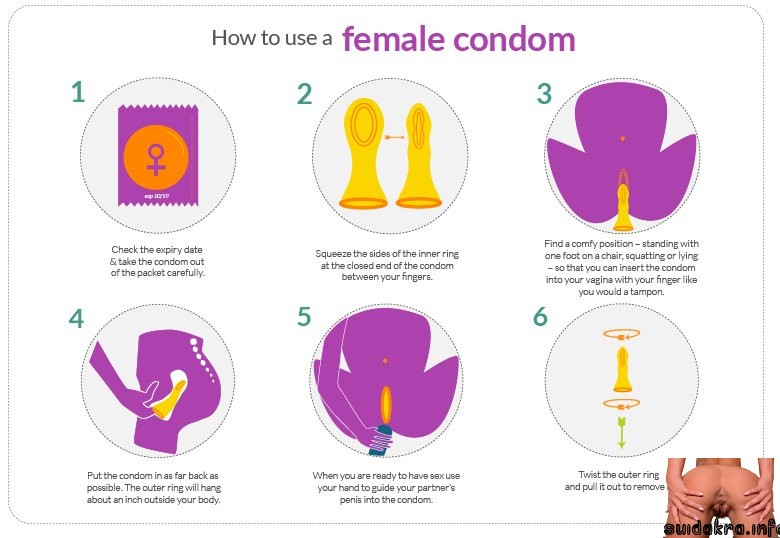 kondom condom sex female infographic condom oral anal vaginal infographics use instructions