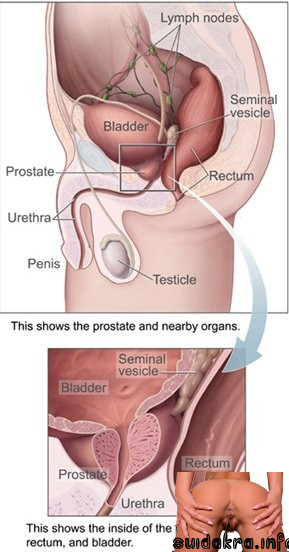 loading pain shown illustration indian couple have anal sex painful