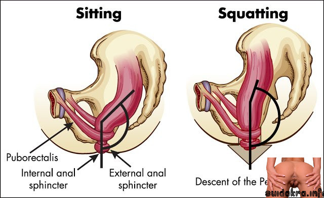 sit posture wrong anal squatting western the best position to have anal sex vs sitting rectal toilet hemorrhoids while stool muscle