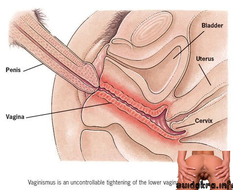 sexual penis sore after sex cum sex4 familydoctor