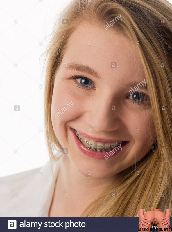 side comp teeth boobs braces alamy camera cute cock space close awake with cum young smiling